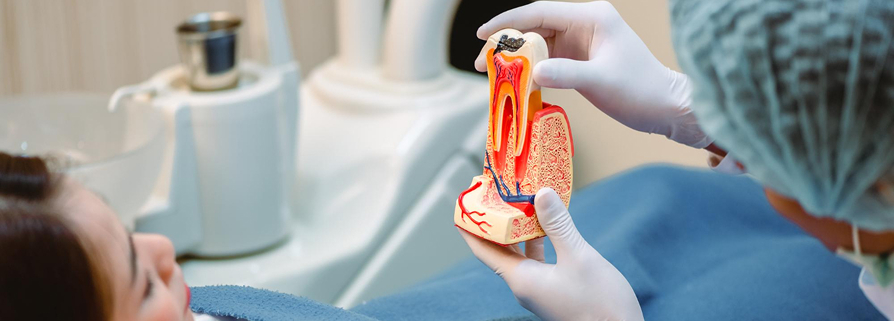 Laser Dentistry for Root Canal Treatment Laser-assisted endodontic treatment for comfortable root canal care in Beaumaris