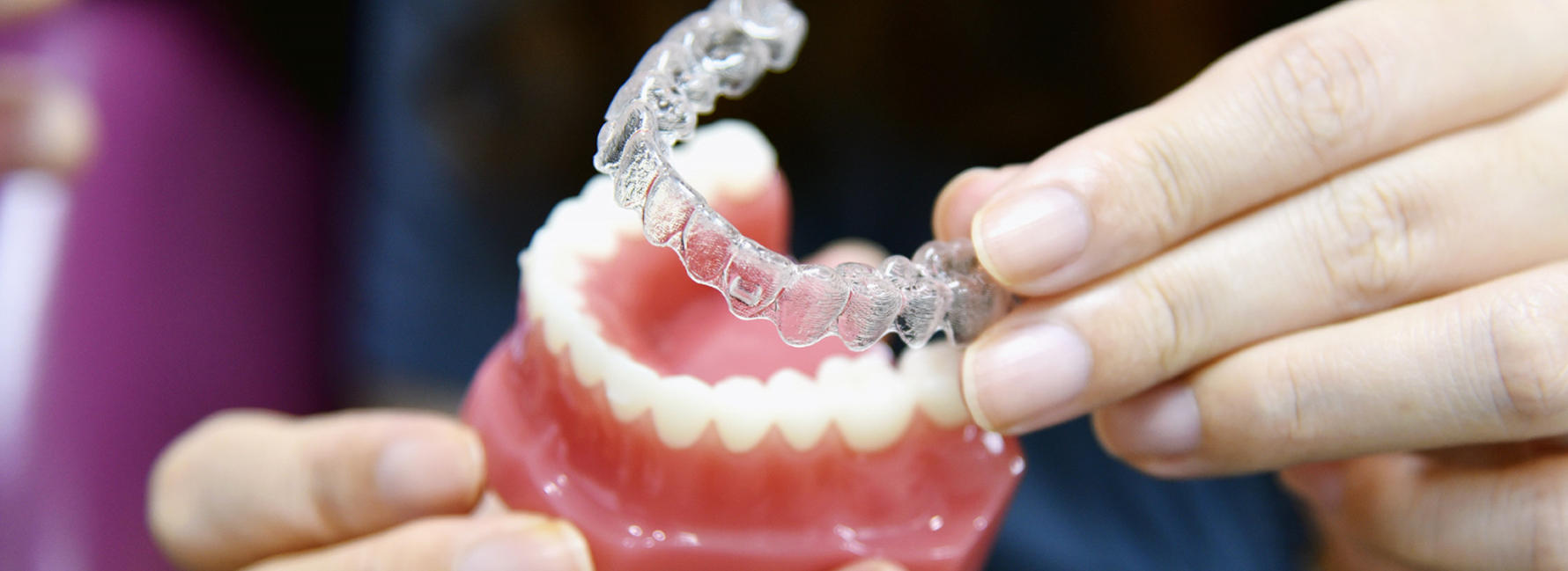 Invisalign Clear Aligners Treatment Close-up of Invisalign clear aligners used to straighten teeth discreetly in Bayside Melbourne