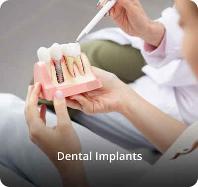 Dental Implants